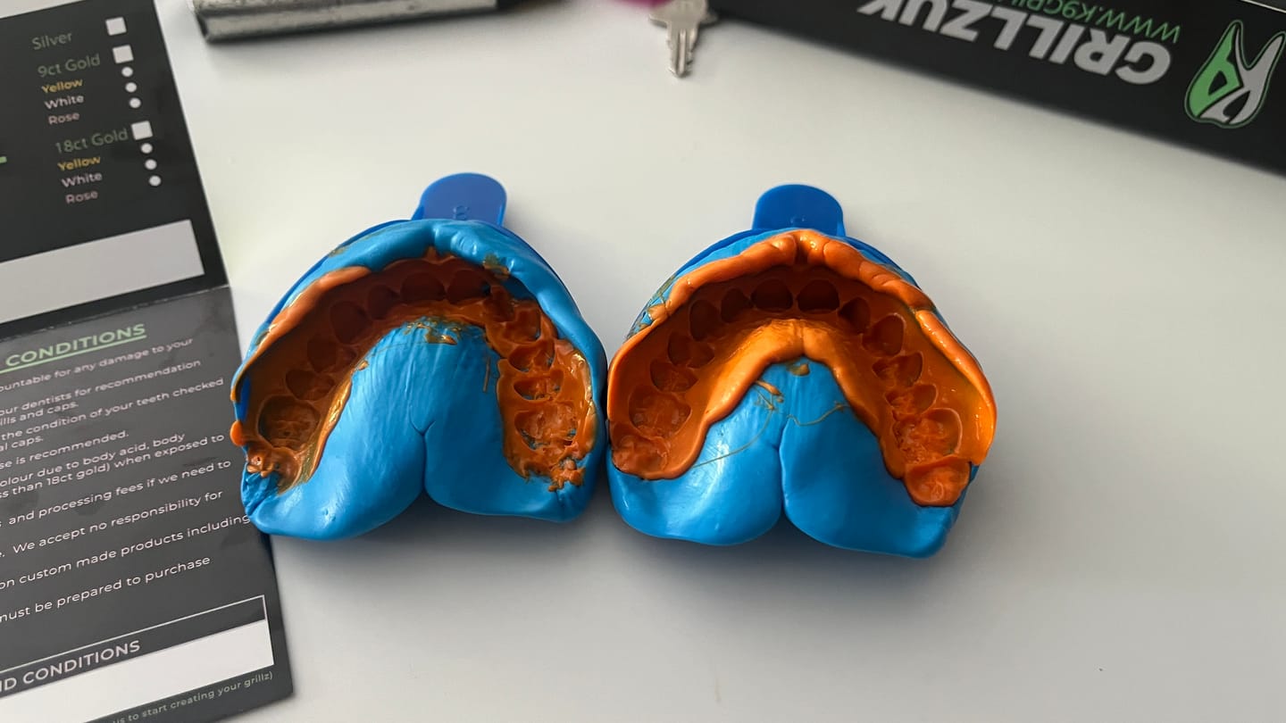 Customer photo review of Upper Impression Kit