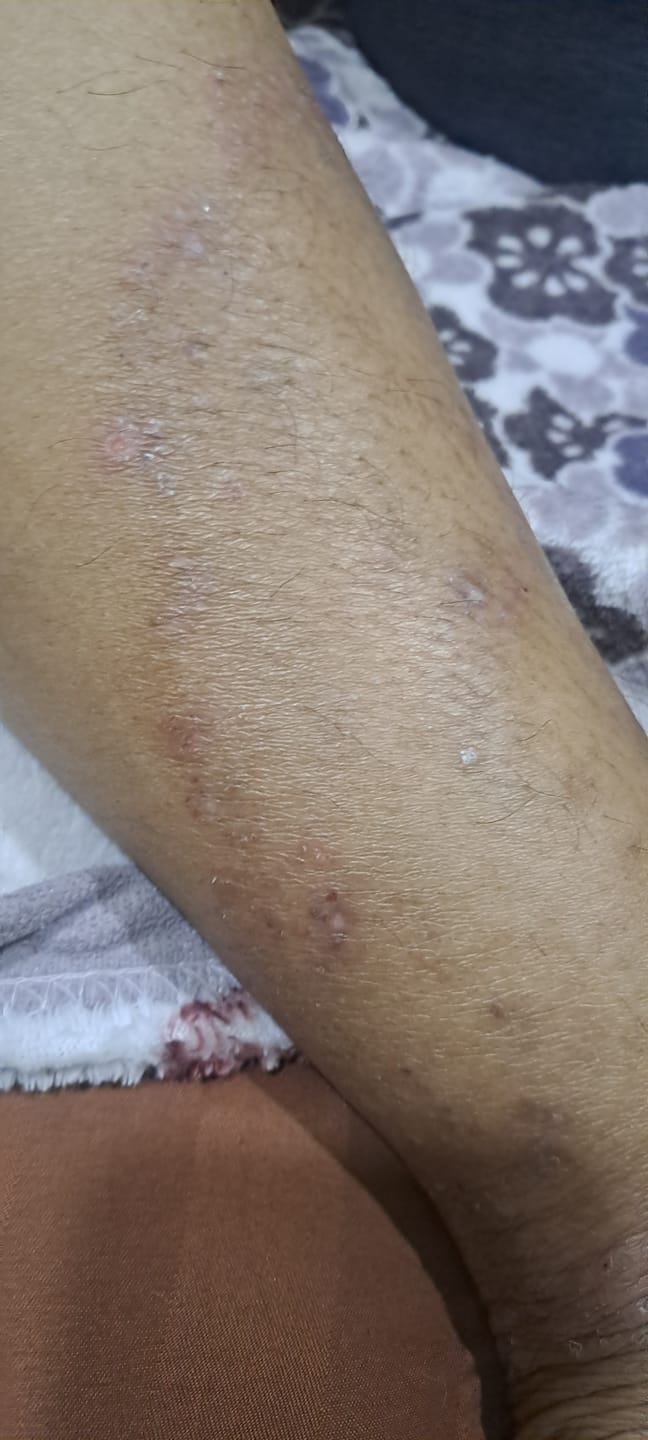Customer photo review of Vitality Combo Pack (2 RCV PRO + 1 Nourri Skin Essence)
