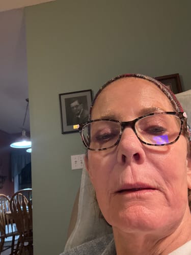 Customer photo review of Grass Fed Tallow & Honey Balm