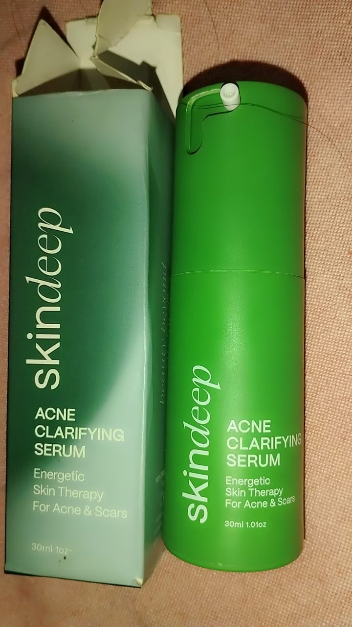 Customer photo review of ACNE CLARIFYING SERUM - Energetic Skin Therapy for Acne & Scars