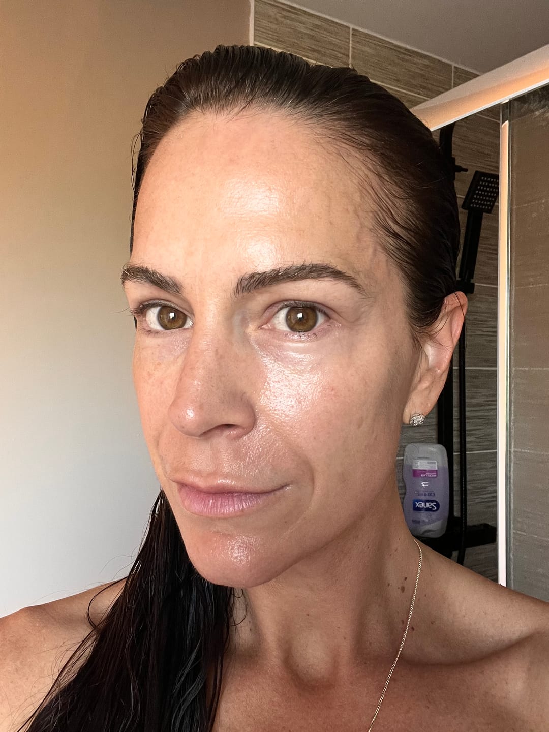 Customer photo review of 5-Step Clear Skin Kit