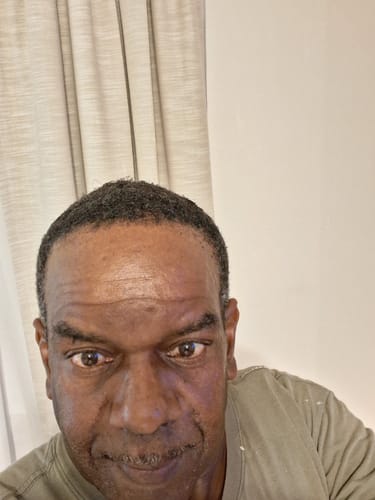 Customer photo review of Four Bottles of Rennora Hair Growth Serum