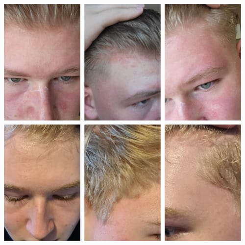 Customer photo review of Seb Natural Soothing Balm