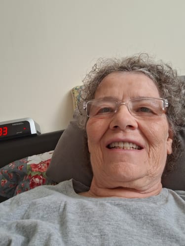 Customer photo review of Neck & Face Firming Kit with Cold Plasma Sub-D+