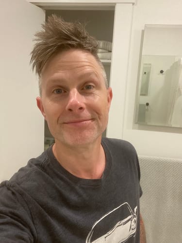 Customer photo review of F-Balm - Premium Anti-aging Tallow Balm - 2 oz.