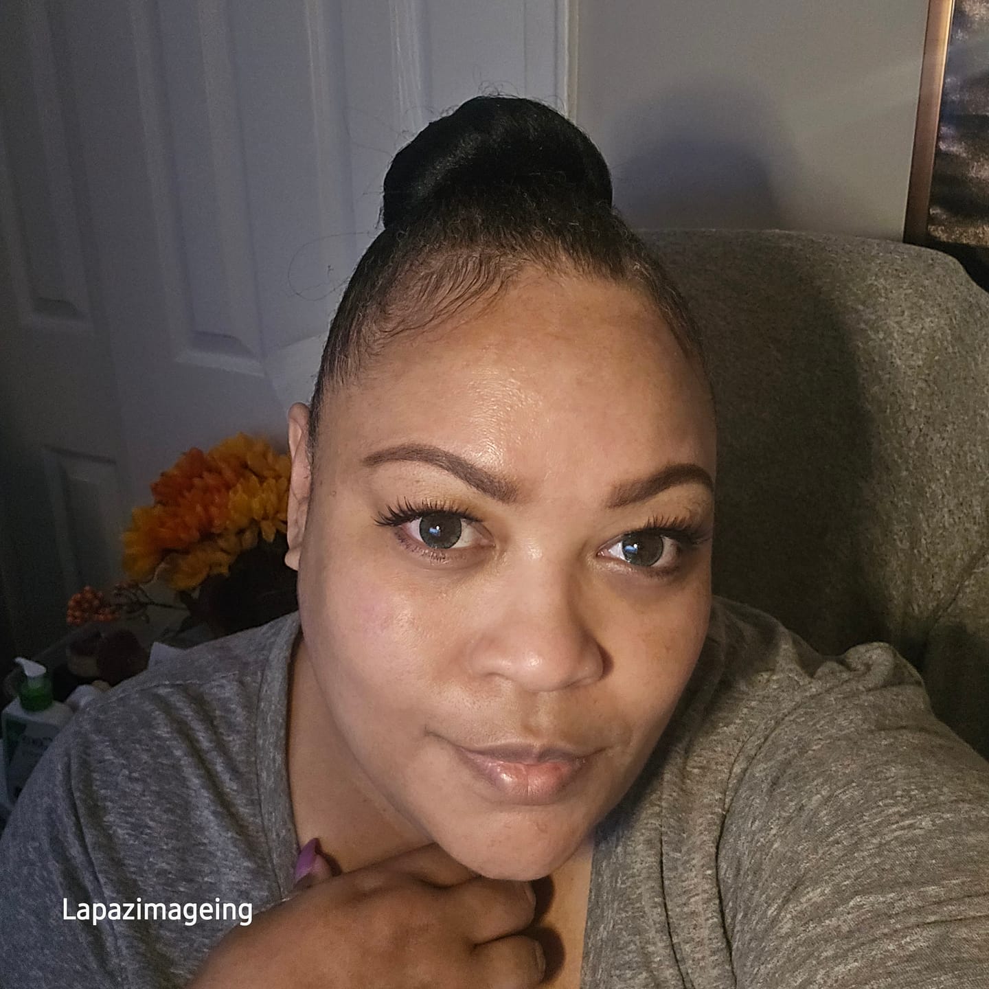 Customer photo review of PDRN retinal eye patch Glow jelly