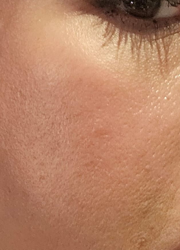 Customer photo review of Ventamin Light Up: Doctor-Formulated Oral Skincare