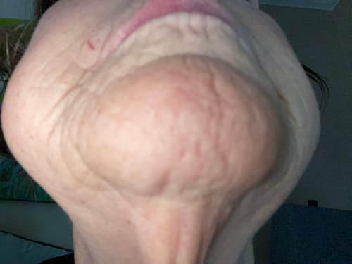 Customer photo review of Facial Hair Removal Cream