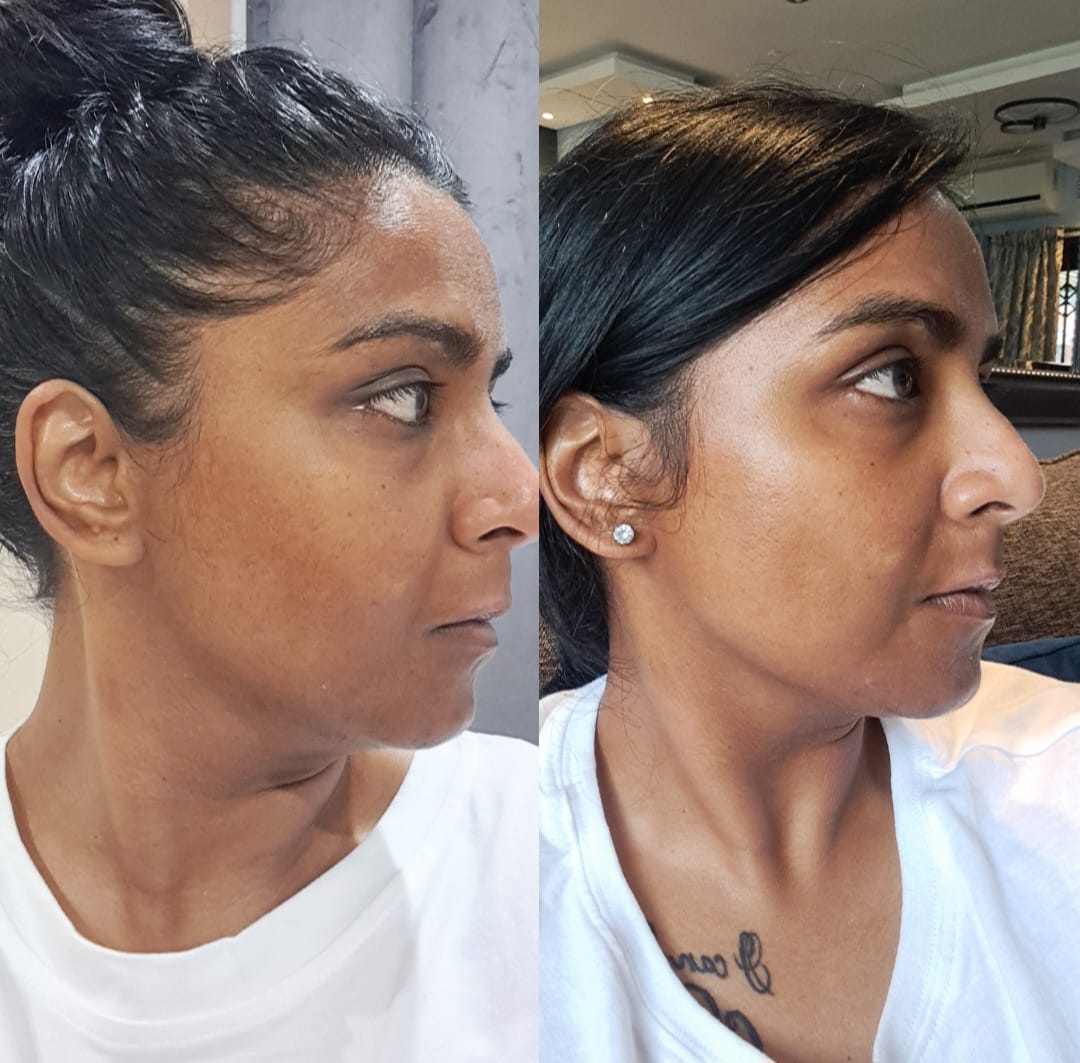 Customer photo review of Super Glaze