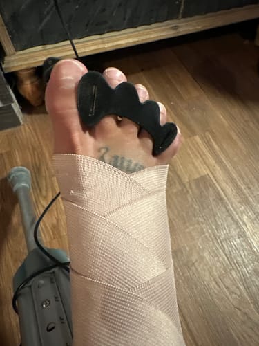 Customer photo review of Splaycers