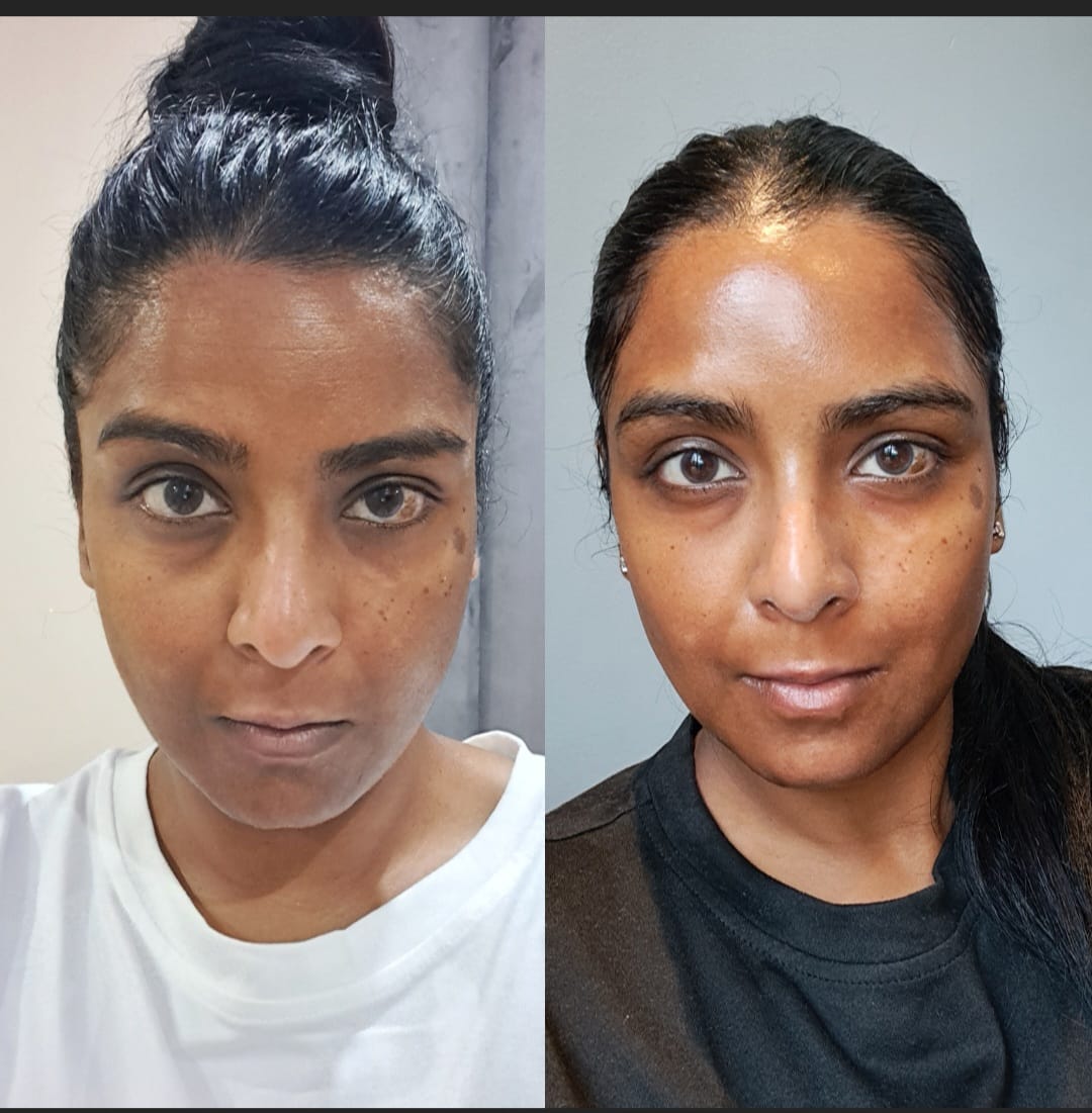 Customer photo review of Super Silk