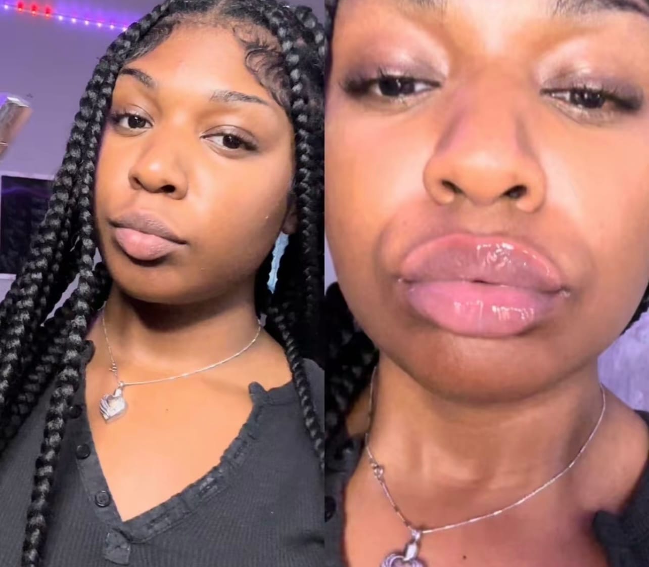 Customer photo review of Plumping Lip filler