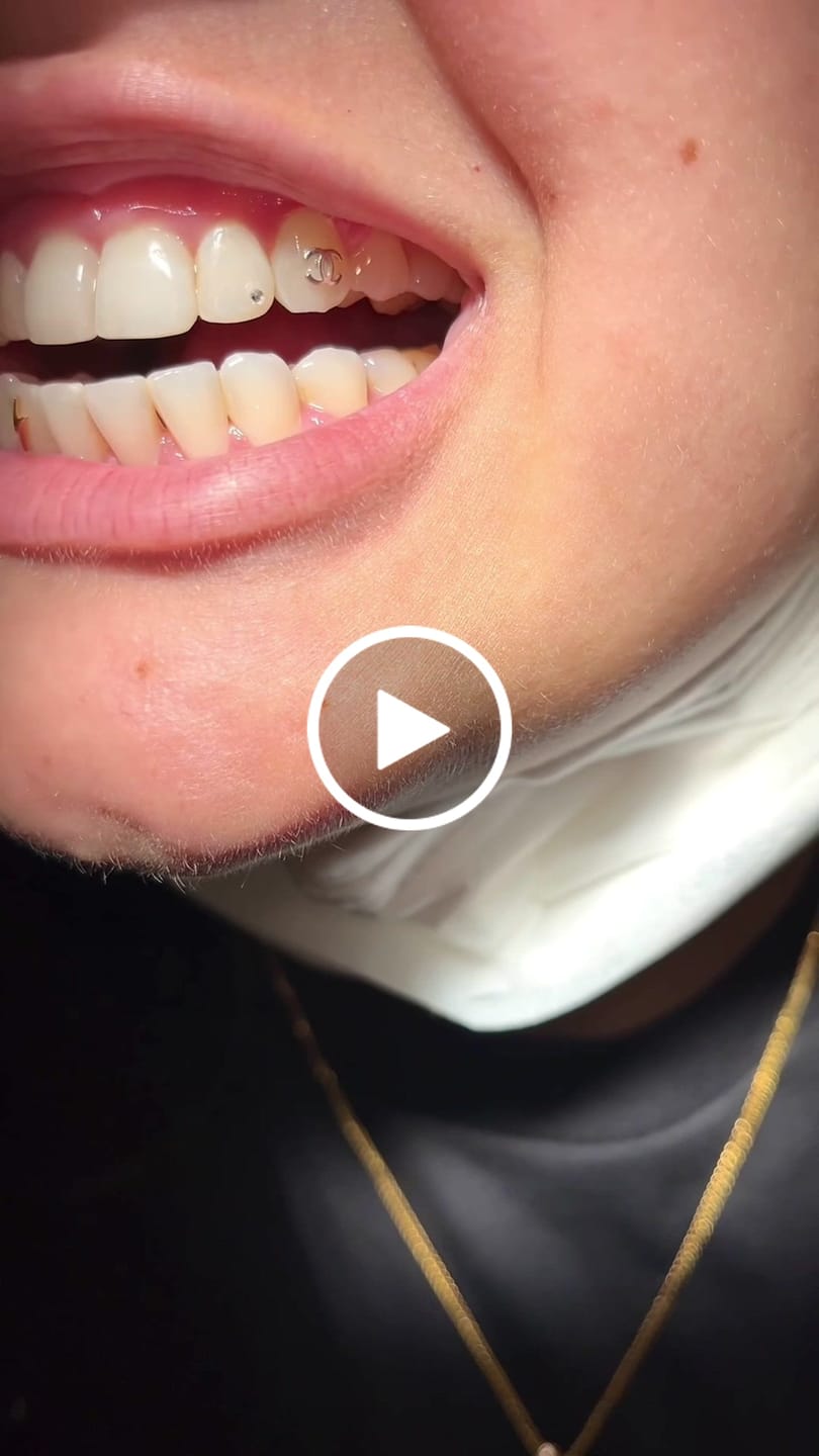 Customer video review of Bolt 22-karat gold