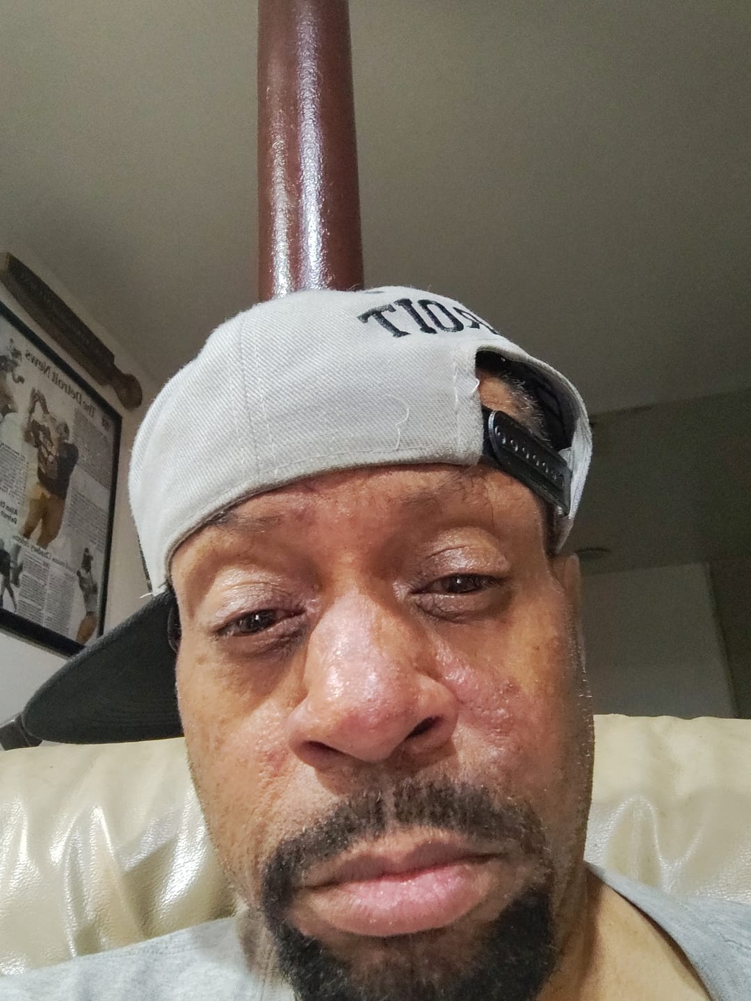 Customer photo review of Acne & Redness Killer