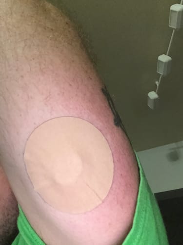 Customer photo review of Skin Grip MAX Dexcom G7 & Stelo Patches - 10 Pack