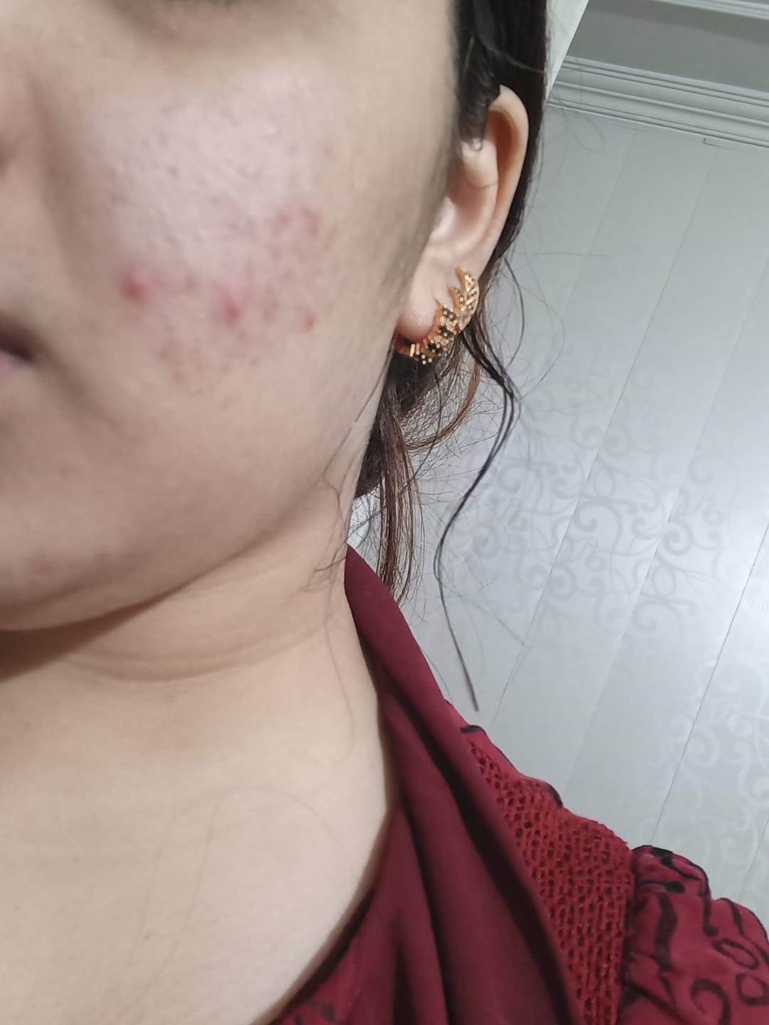 Customer photo review of MandelAC Cream