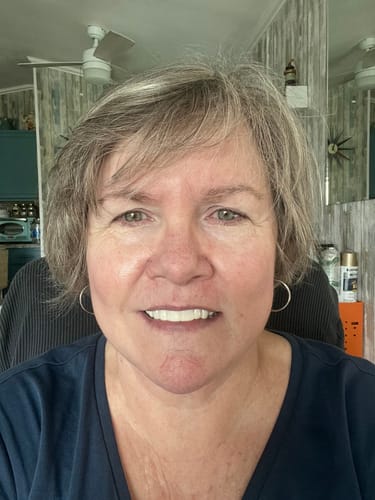 Customer photo review of Pop On Veneers with Impression Kit