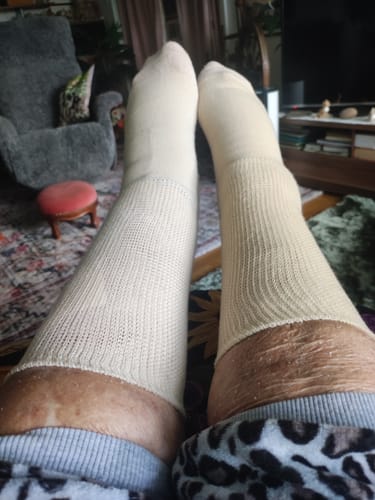 Customer photo review of Diasocks Komfortstrumpor