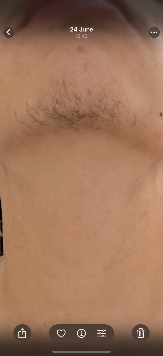 Customer photo review of Sérum Thorin | Huile de croissance de Barbe