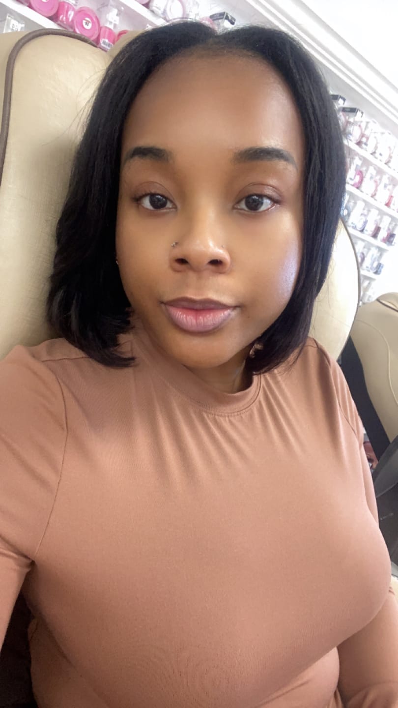 Customer photo review of Acne And Blemish Solution - Large