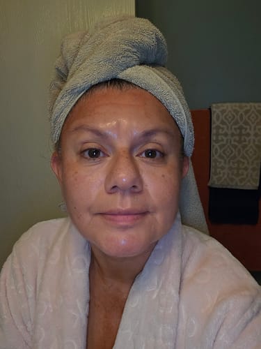 Customer photo review of Glov Micro Infusion System