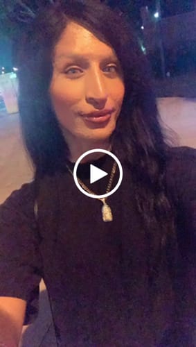 Customer video review of BEST Seller 2ml Extreme Instant Lip Filler