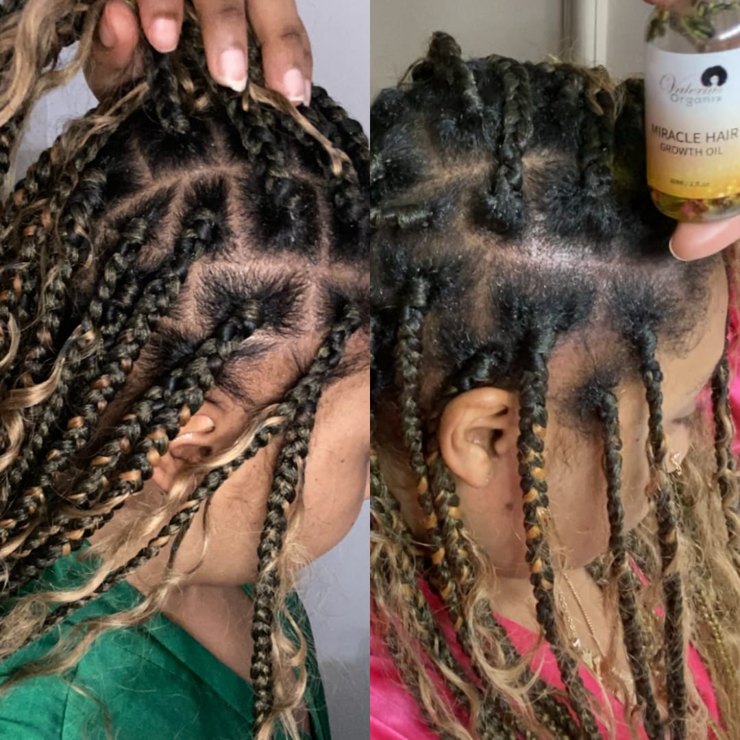 Customer photo review of Miracle Hair Growth Oil