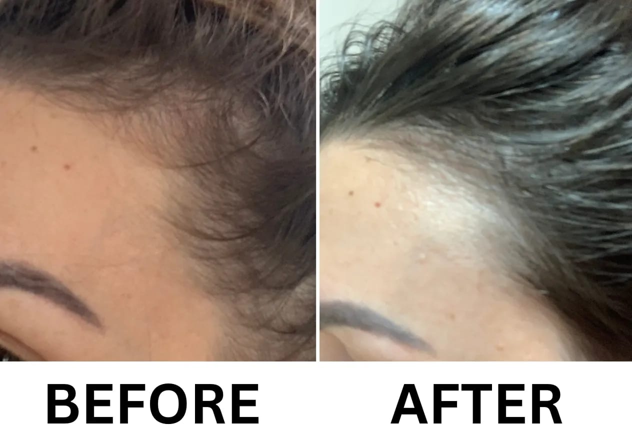 Customer photo review of Fulica Rx™ - Novexion⁺ Anti-Dandruff Shampoo