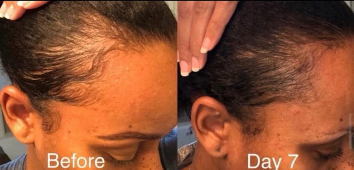 Customer photo review of Miracle Hair Growth Oil