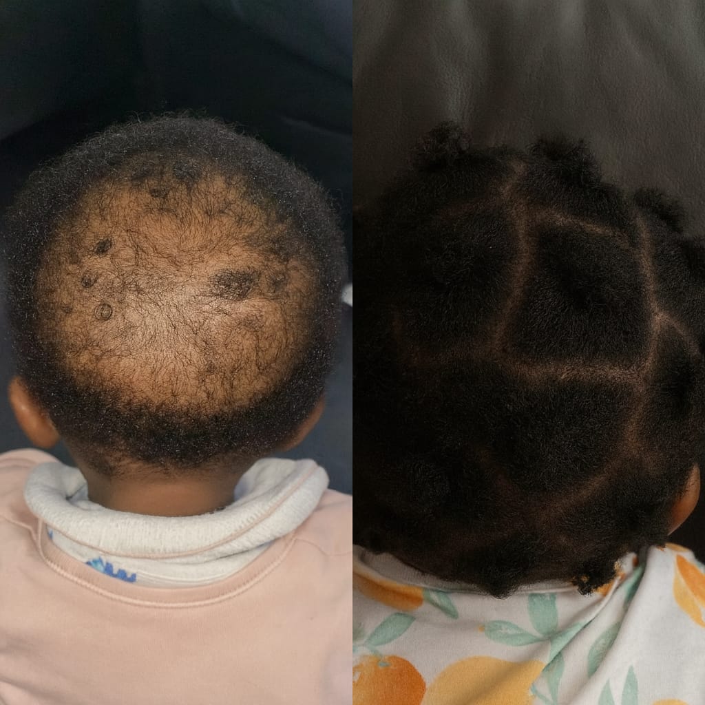 Customer photo review of Miracle Hair Growth Oil