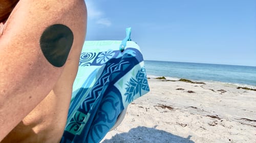 Customer photo review of Skin Grip MAX Dexcom G7 & Stelo Patches - 10 Pack