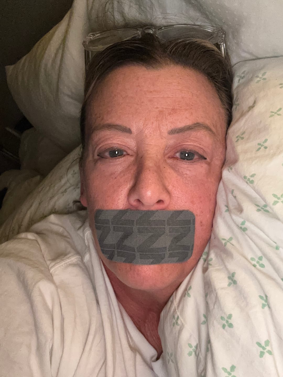 Customer photo review of ZzzTape - Mouth Tape