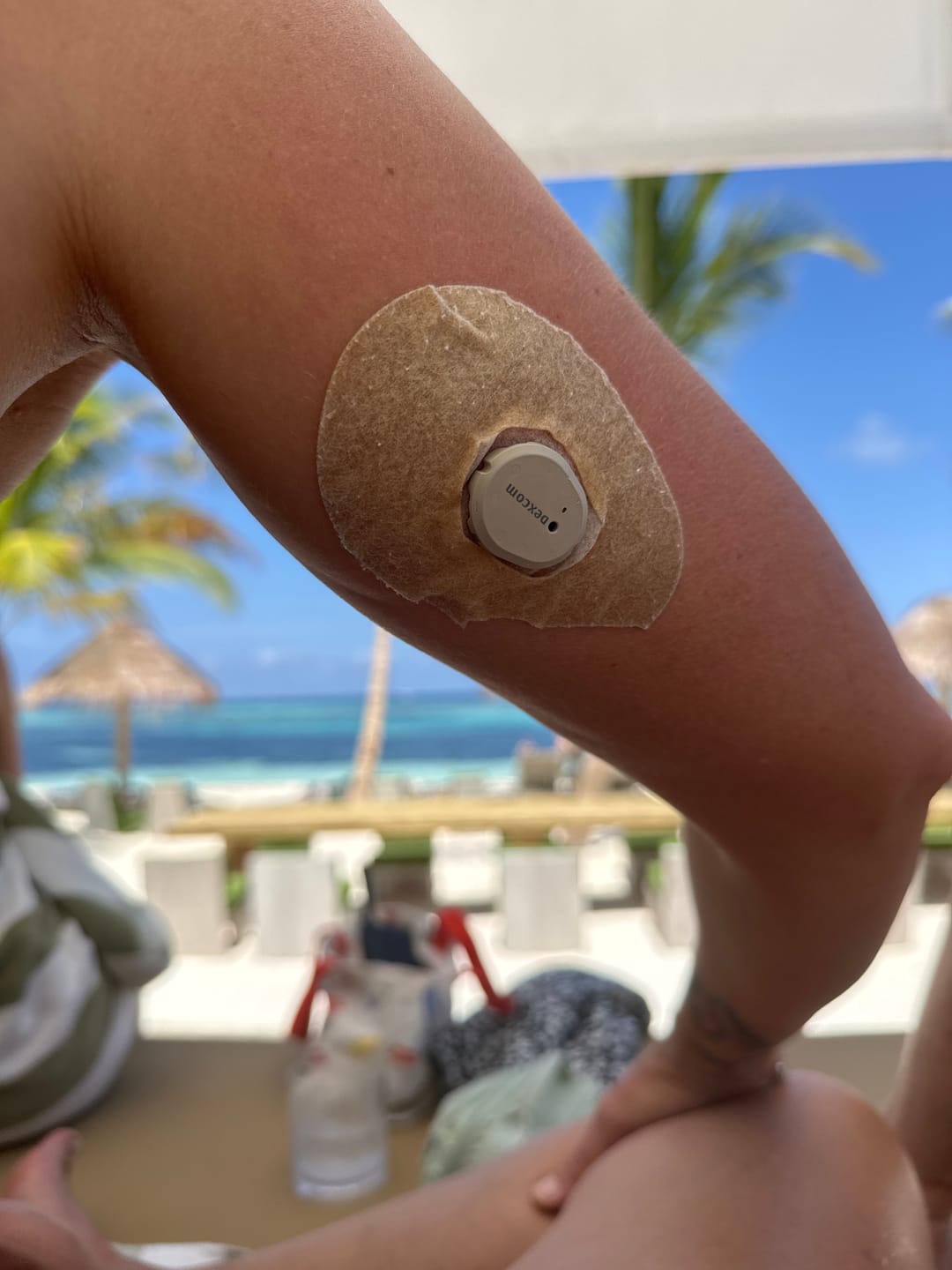 Customer photo review of Stayactive Sport CGM-Sensor overpatches Beige För Dexcom G7