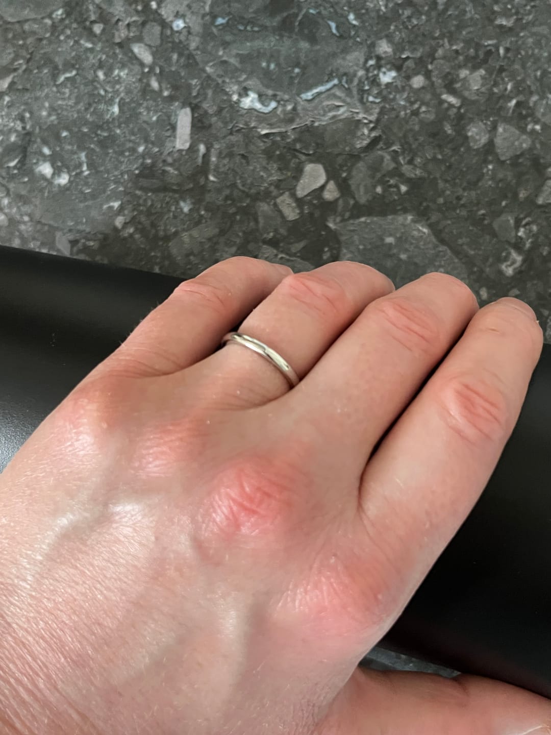 Customer photo review of White Gold 2mm Wonder Ring