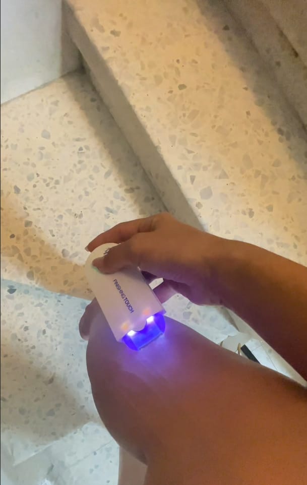 Customer photo review of VelvetaSkin™ - מכשיר להסרת שיער.