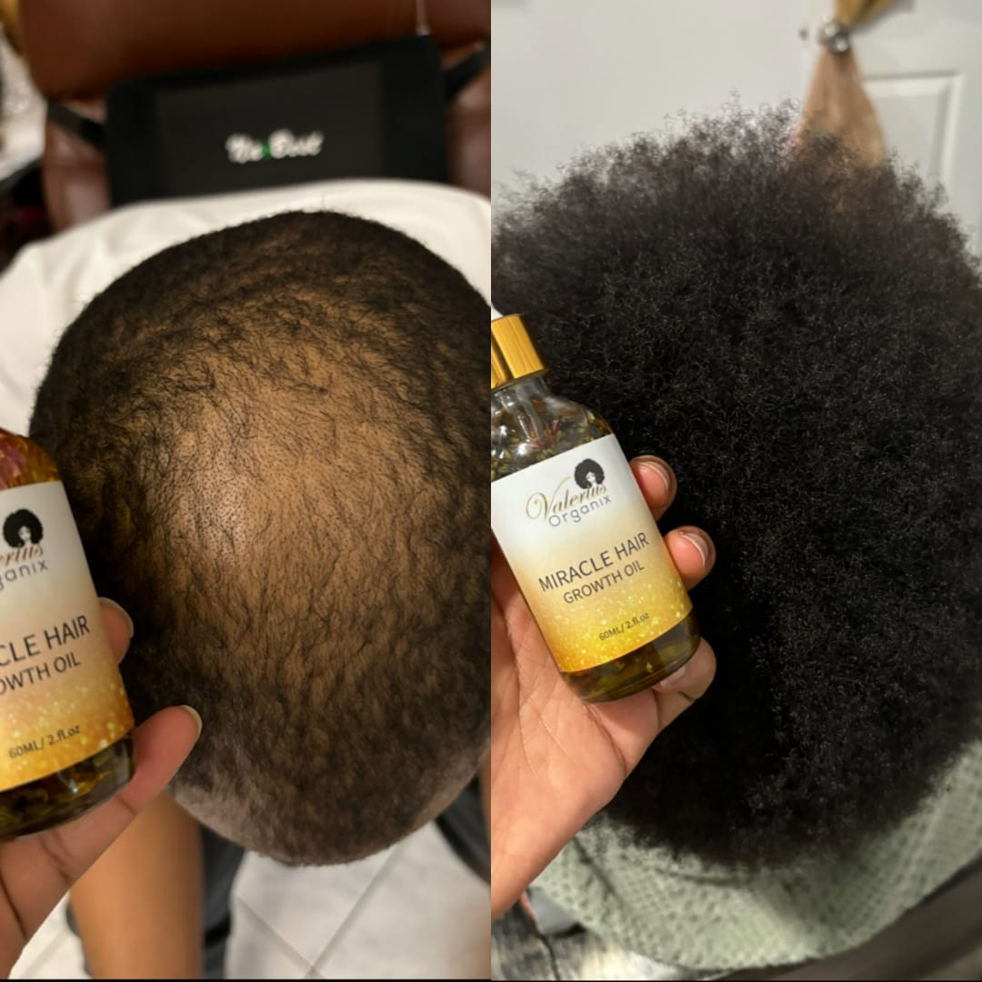 Customer photo review of Miracle Hair Growth Oil