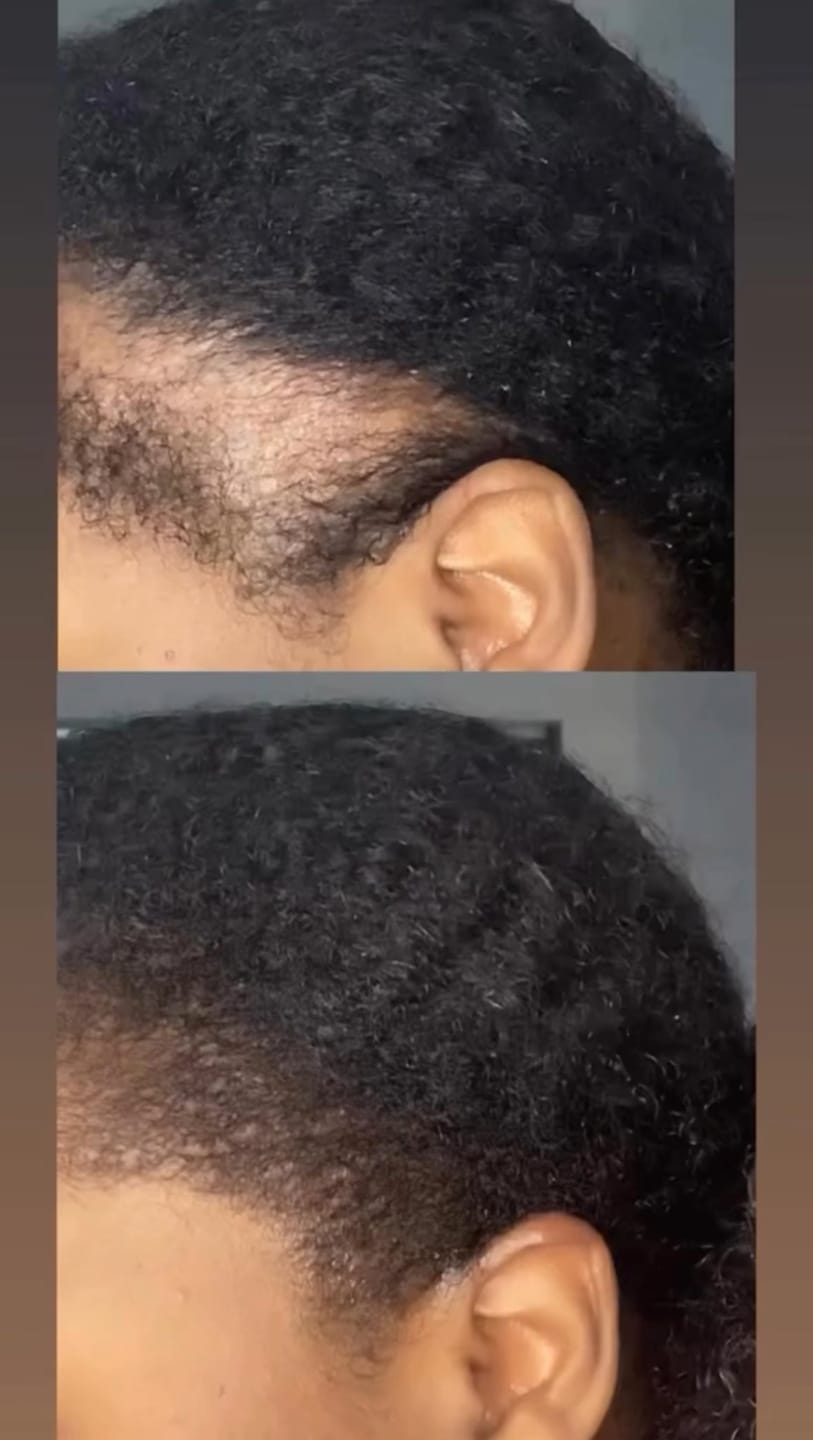 Customer photo review of Miracle Hair Growth Oil