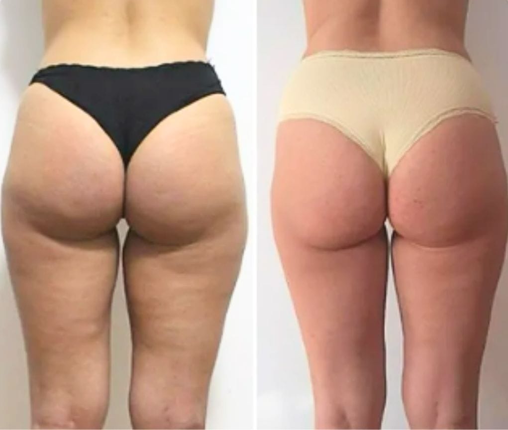 Customer photo review of CelluLuxe - Pro NEU
