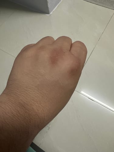 Customer photo review of Jolicare Cream