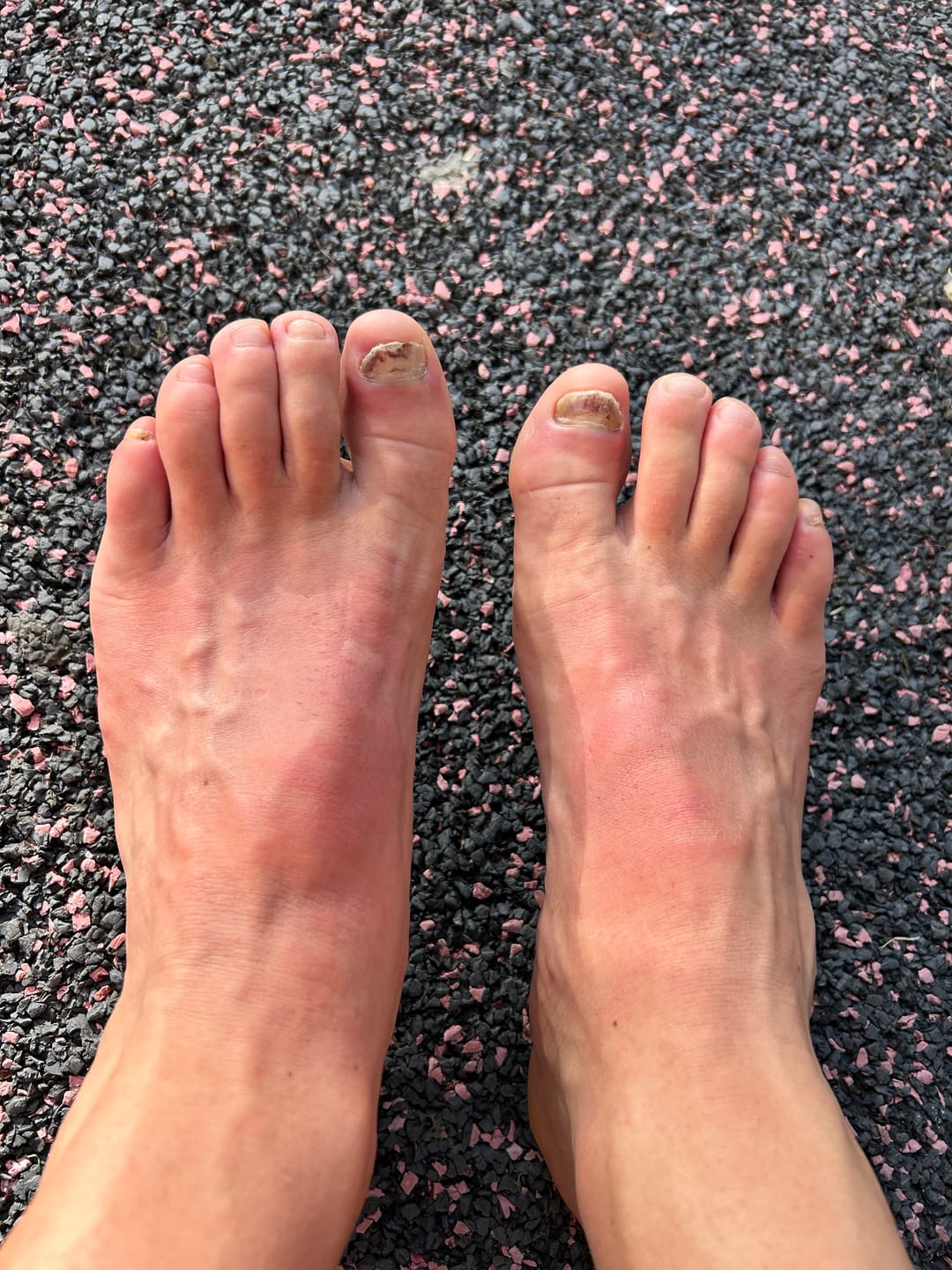 Customer photo review of Baume SOS Frottements 65g - Evite et répare les frottements