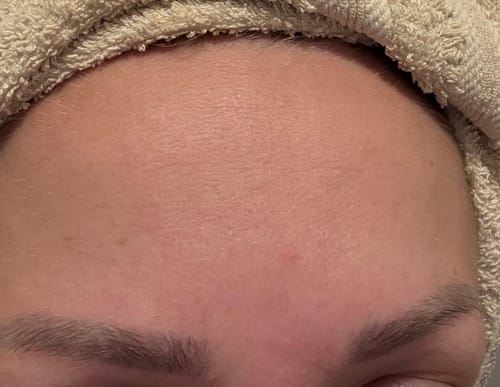 Customer photo review of BHA Tonik - Tonik s BHA kiselinama