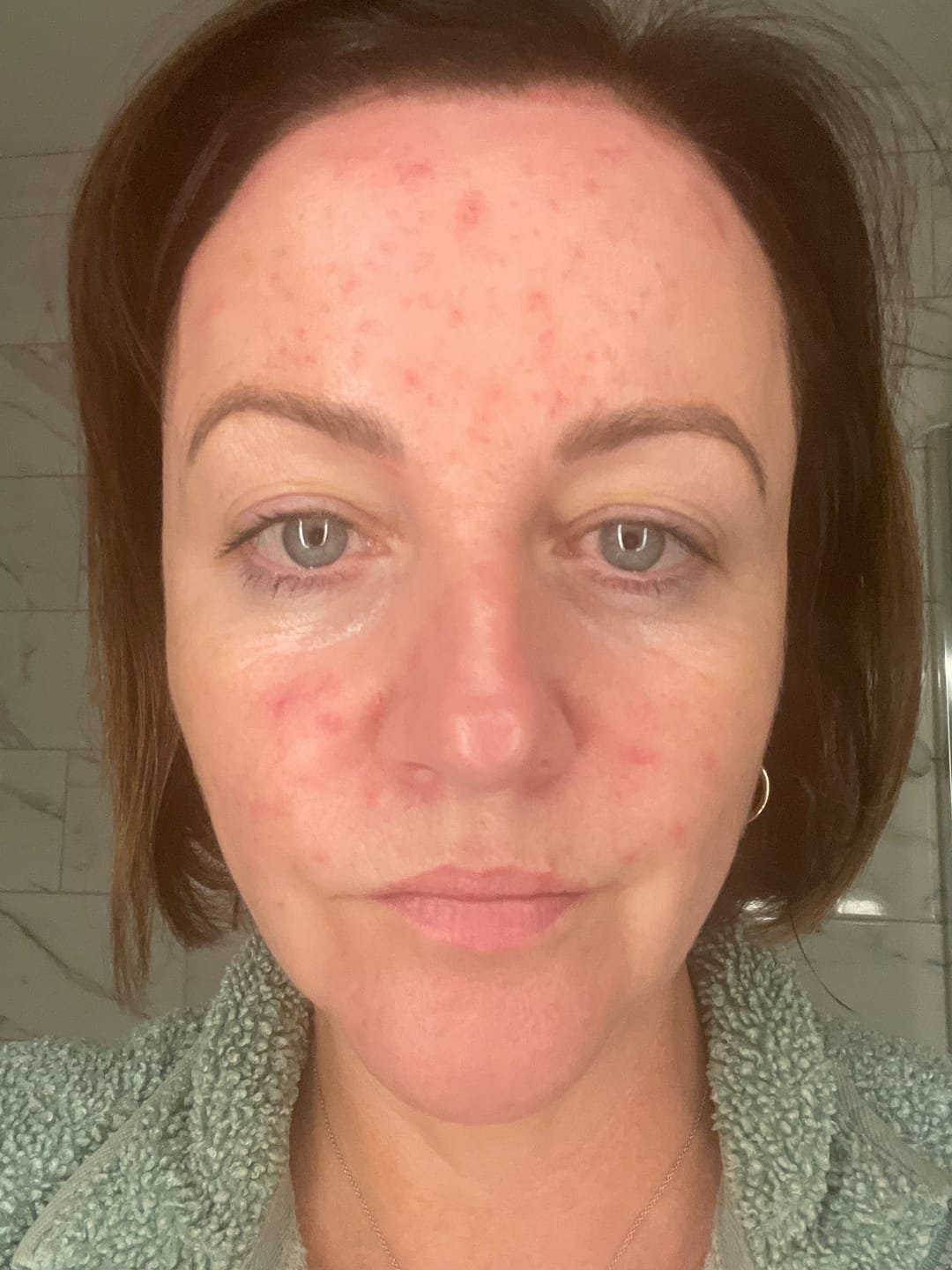 Customer photo review of Rosalique 3 in 1 Balm Cleanser
