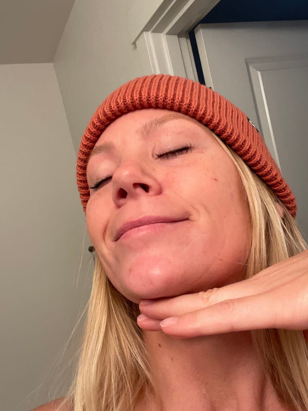 Customer photo review of Ultra Facial Detoxifying Protocol