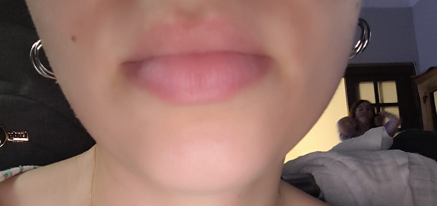 Customer photo review of LIPBALM DE PEPTÍDEOS