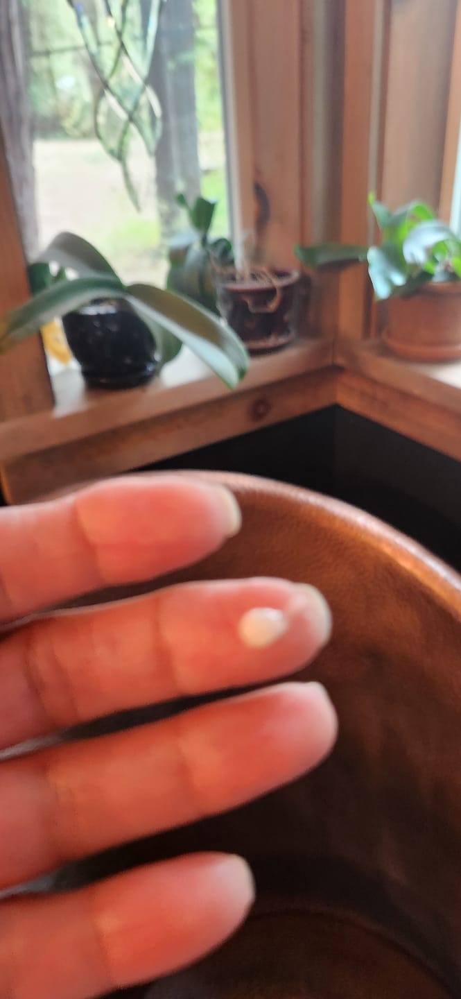 Customer photo review of Glutathione Topical Support