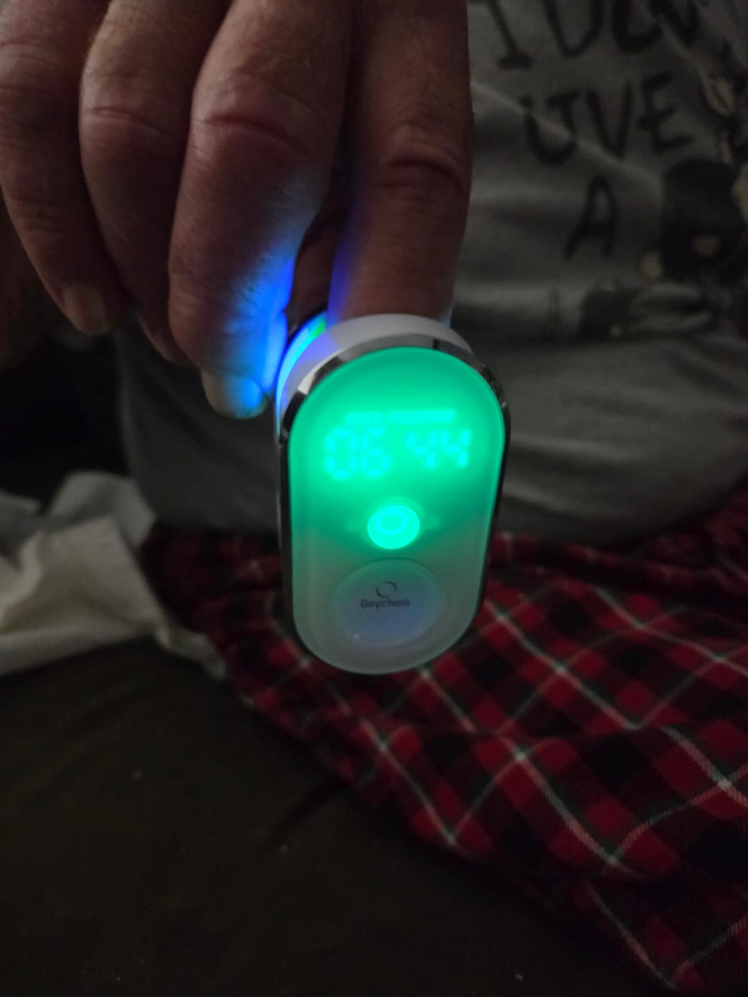 Customer photo review of Onychom Pro Antifungal LED Device
