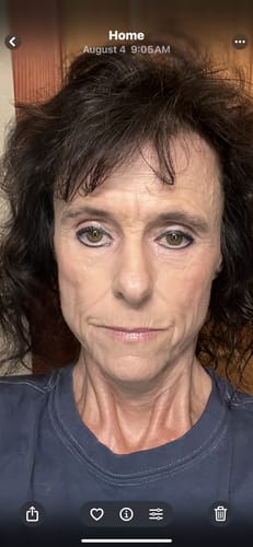 Customer photo review of Grass Fed Tallow & Honey Balm