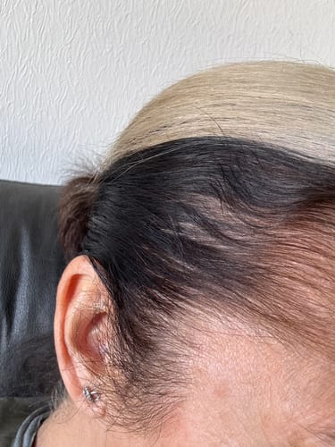 Customer photo review of Seb Natural Calming Serum