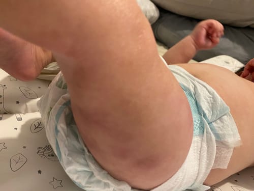 Customer photo review of Calm Balm