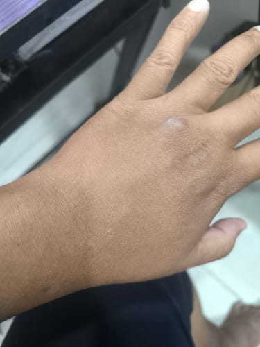 Customer photo review of Jolicare Cream